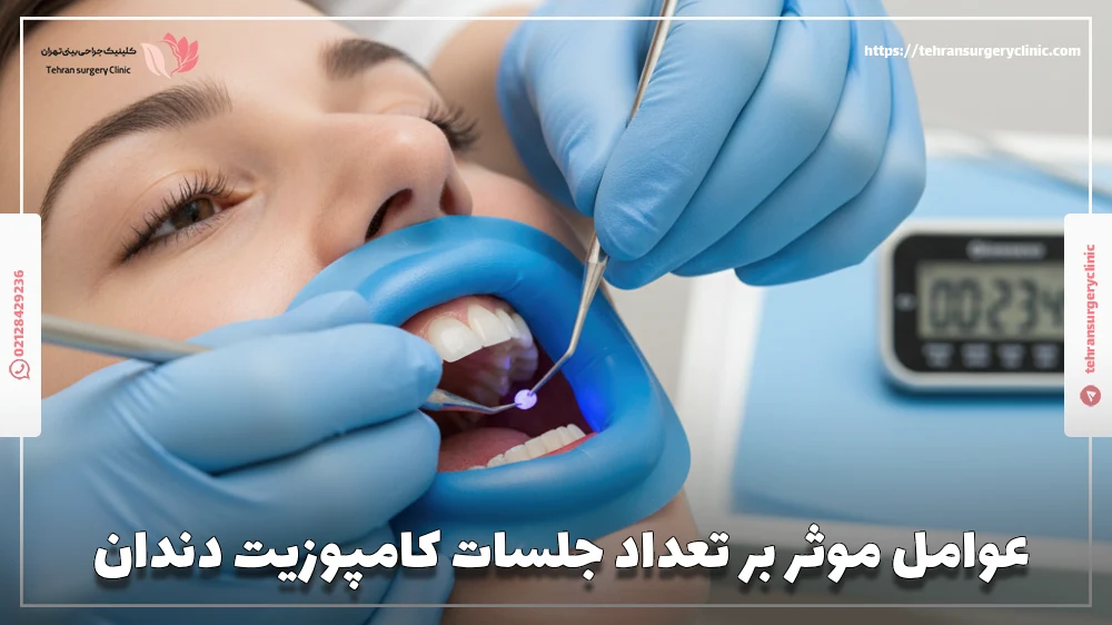 عوامل موثر بر تعداد جلسات کامپوزیت دندان