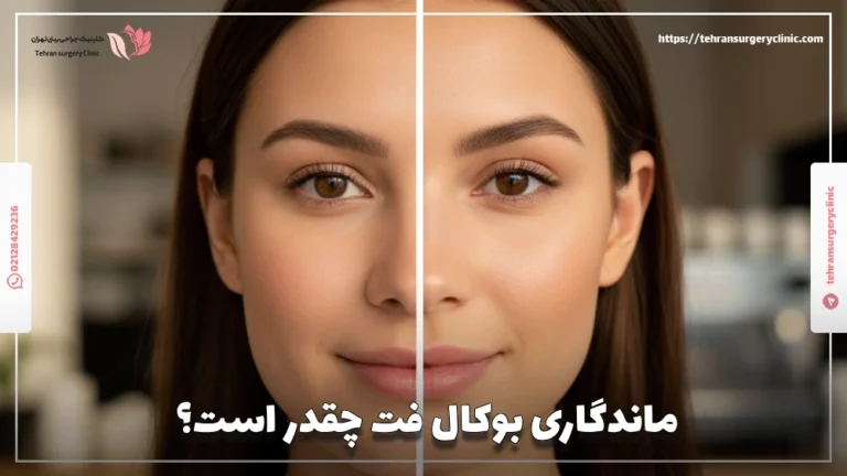 ماندگاری بوکال فت چقدر است: عوامل موثر و راه‌های افزایش ماندگاری بوکال فت