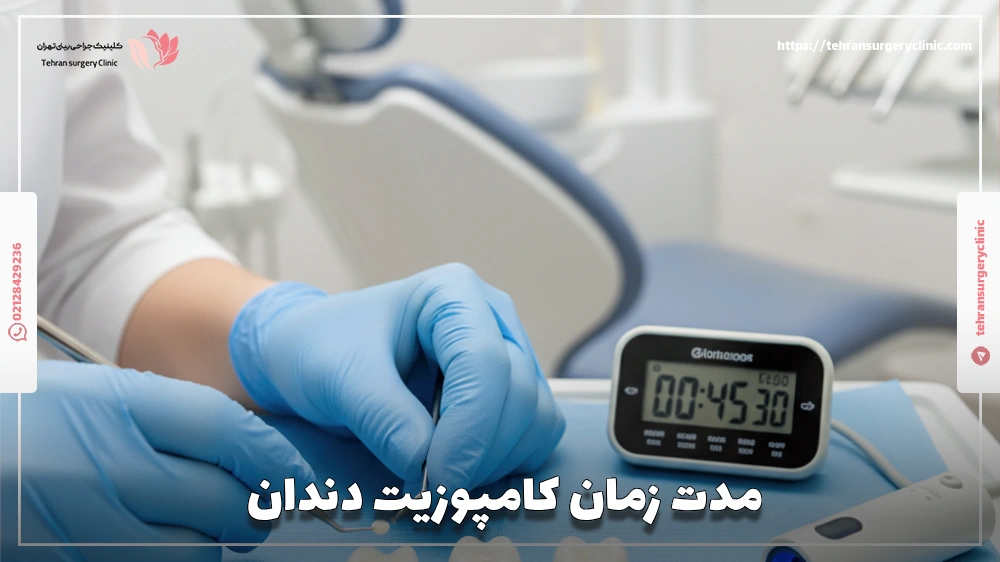 مدت زمان کامپوزیت دندان