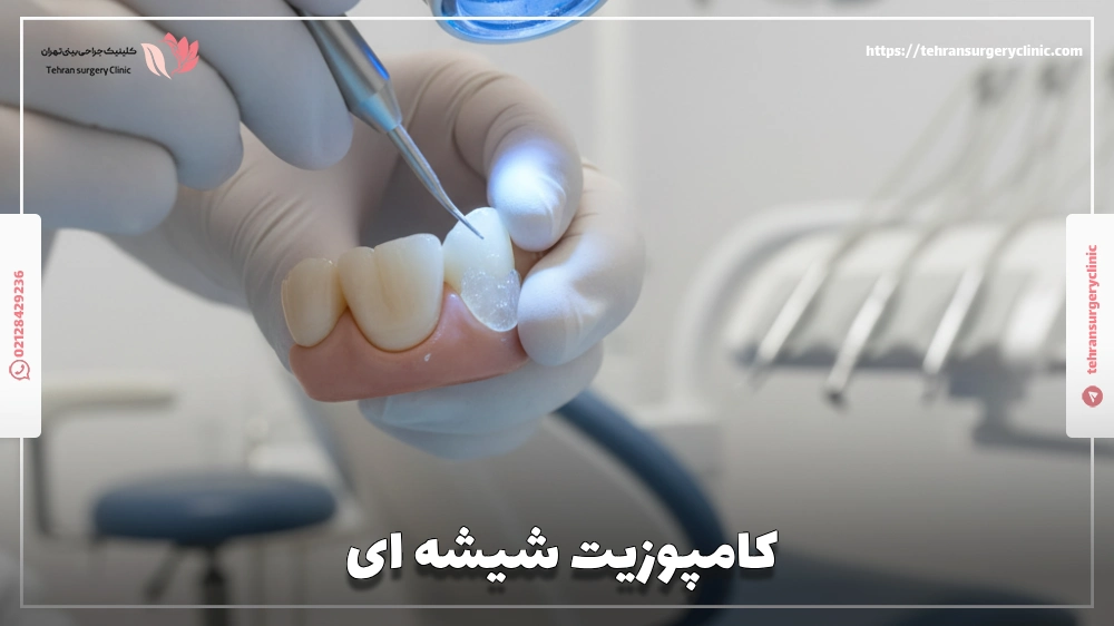 کامپوزیت شیشه ای