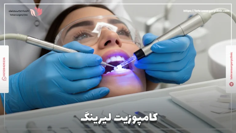 کامپوزیت لیرینگ چیست: عوارض و میزان ماندگاری