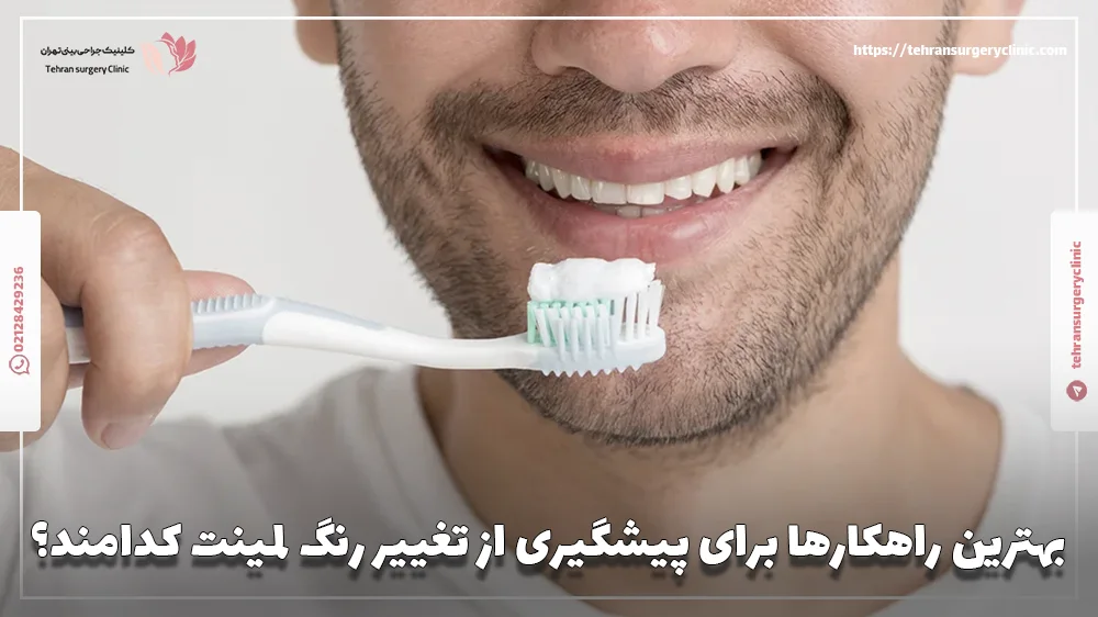 بهترین راهکارها برای پیشگیری از تغییر رنگ لمینت کدامند؟