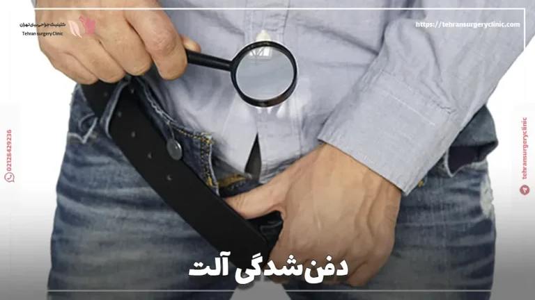 دفن‌شدگی آلت: درمان بیماری آلت دفن شده