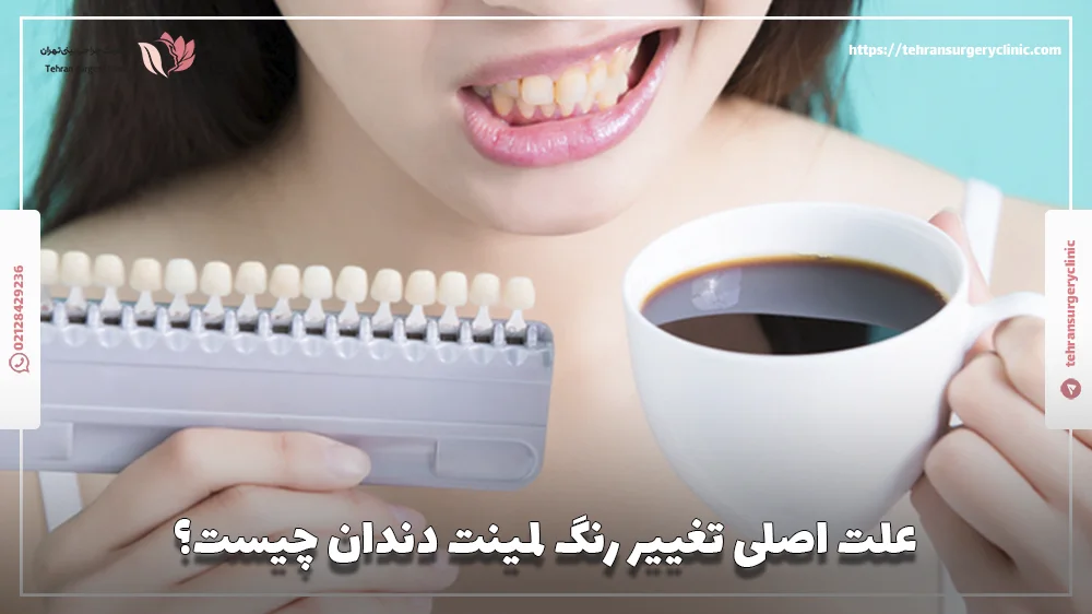علت اصلی تغییر رنگ لمینت دندان چیست؟