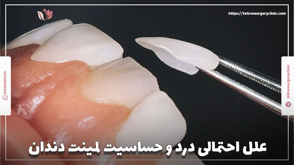 علل احتمالی درد و حساسیت لمینت دندان