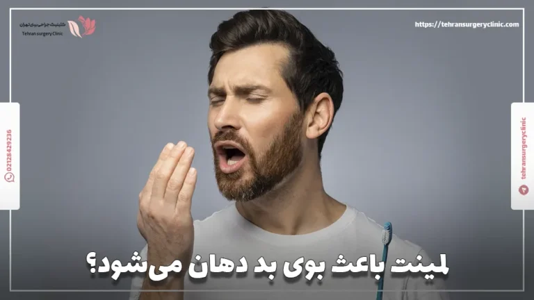 لمینت باعث بوی بد دهان می‌شود؟