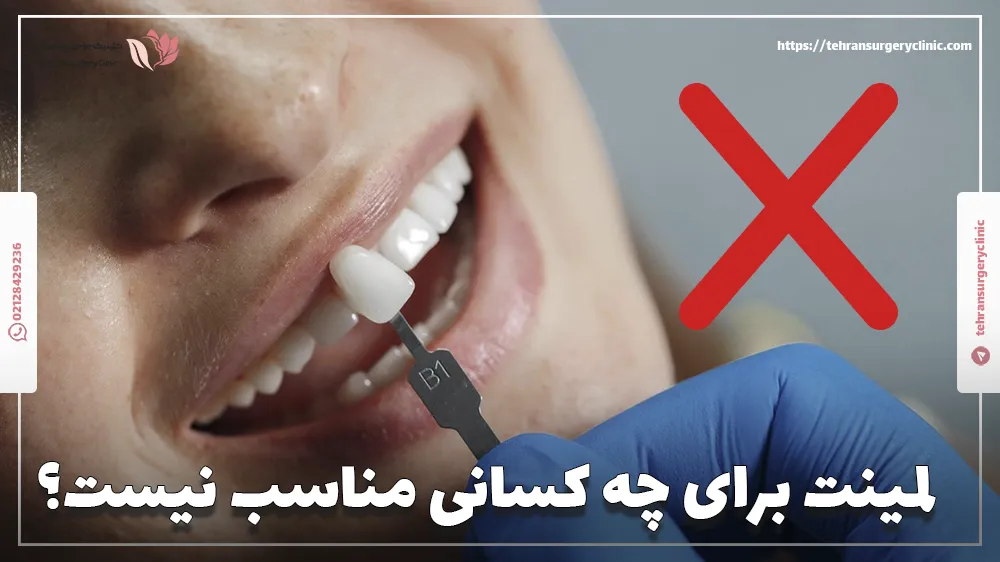 لمینت برای چه کسانی مناسب نیست؟