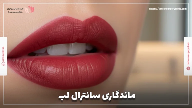 ماندگاری سانترال لب چقدر است: عوامل موثر