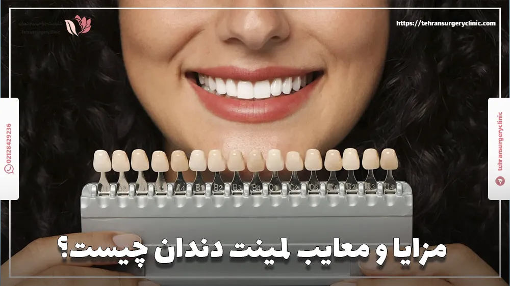 مزایا و معایب لمینت دندان چیست؟