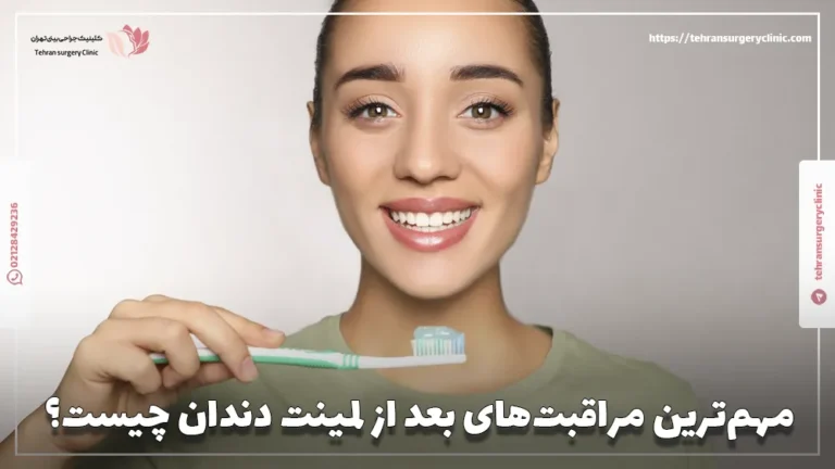 مهم‌ترین مراقبت‌های بعد از لمینت دندان چیست؟