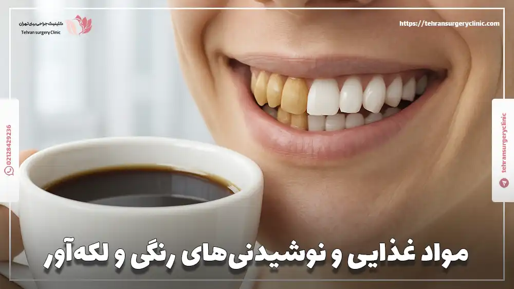 مواد غذایی و نوشیدنی‌های رنگی و لکه‌آور