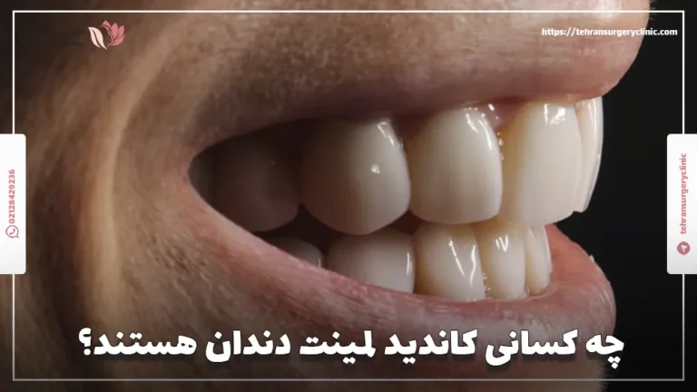 چه کسانی کاندید لمینت دندان هستند؟