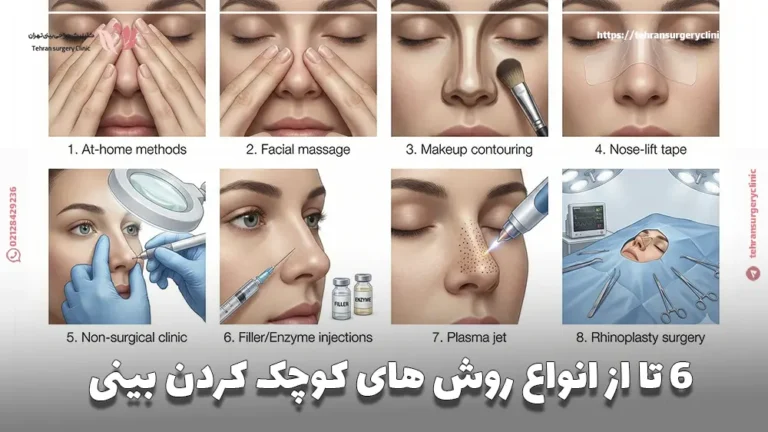 6 تا از انواع روش های کوچک کردن بینی (از راهکار خانگی تا جراحی)