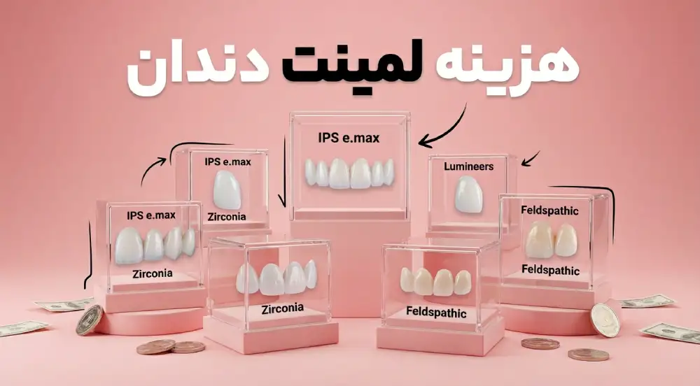 تاثیر برندهای ایمپلنت روی هزینه ایمپلنت