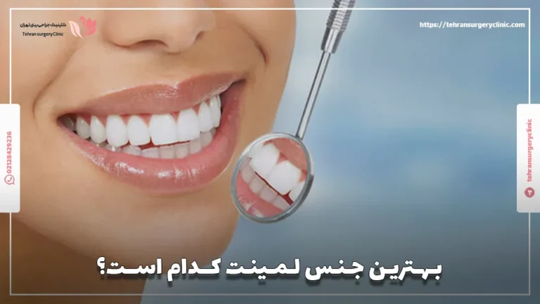بهترین جنس لمینت کدام است؟