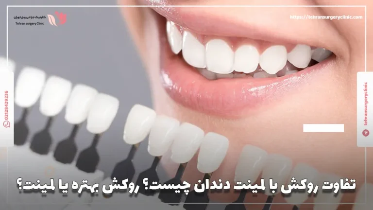 تفاوت روکش با لمینت دندان چیست؟ روکش بهتره یا لمینت؟