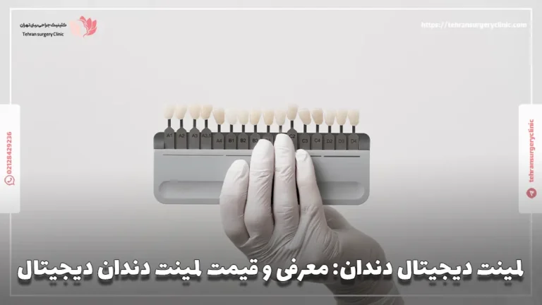 لمینت دیجیتال دندان: معرفی و قیمت لمینت دندان دیجیتال