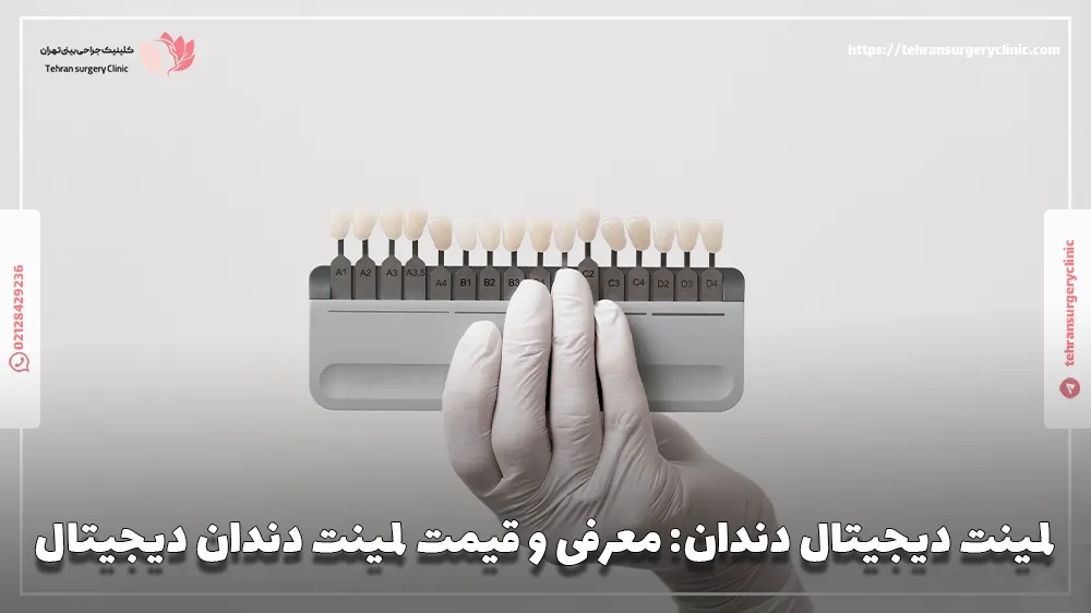 لمینت دیجیتال دندان
