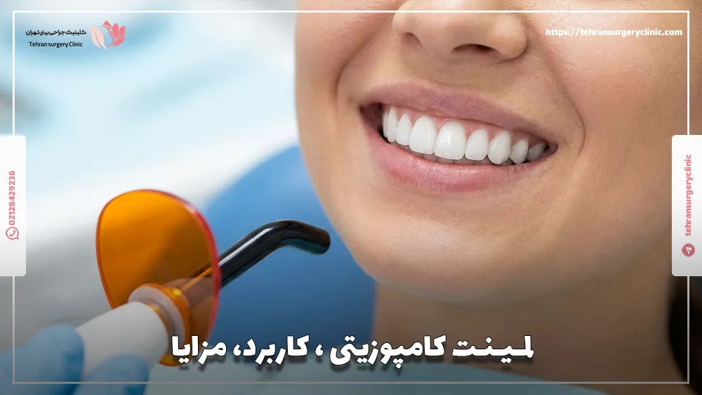یک خانم جوان دارای لمینت کامپوزیتی