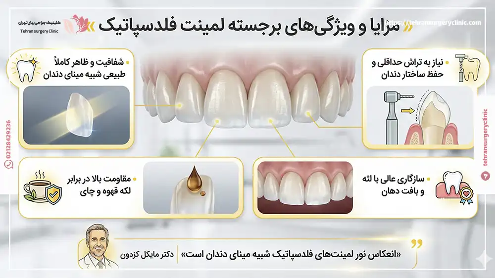 مزایا و ویژگی‌های برجسته لمینت فلدسپاتیک