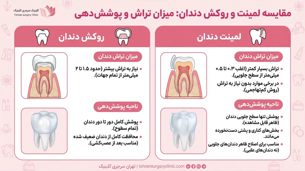 اینفوگرافیک مقایسه لمینت و روکش