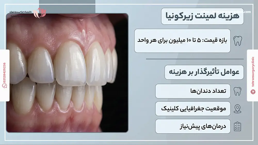 هزینه لمینت زیرکونیا