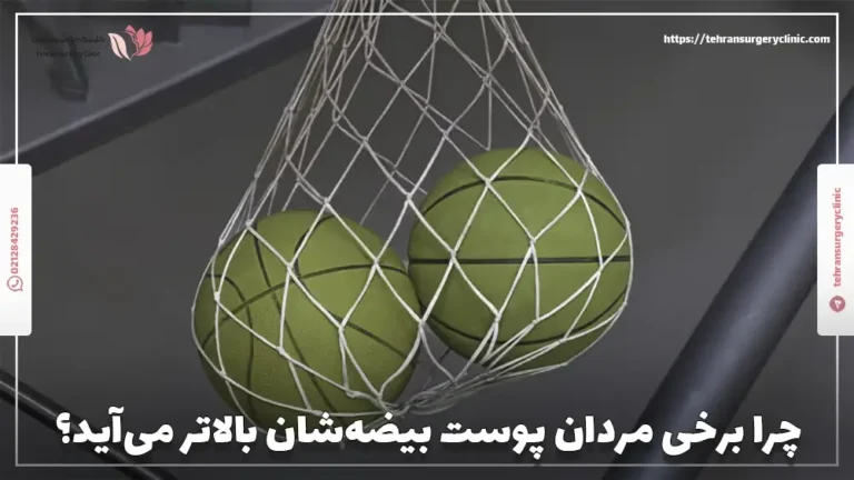 چرا برخی مردان پوست بیضه‌شان بالاتر می‌آید؟
