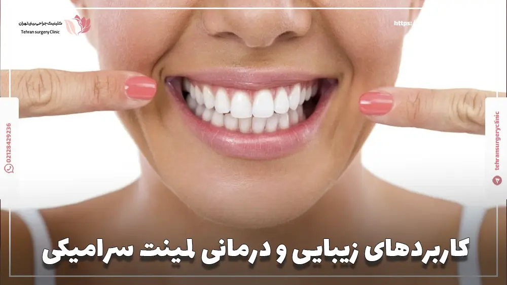 کاربردهای زیبایی و درمانی لمینت سرامیکی