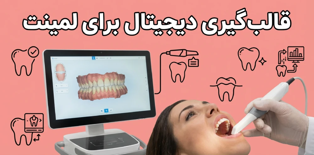 پزشک در حال قالب گیری دیجیتال برای لمینت دندان است.