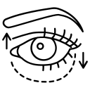 بلفاروپلاستی