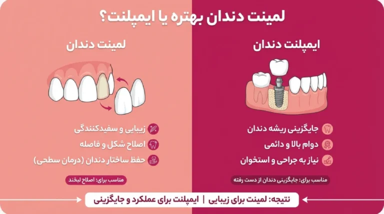 لمینت دندان بهتره یا ایمپلنت؟