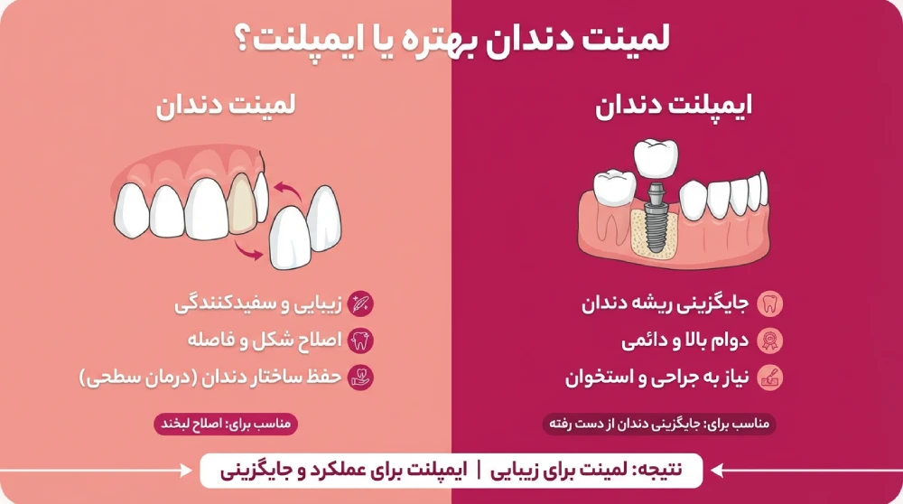 لمینت دندان بهتره یا ایمپلنت؟