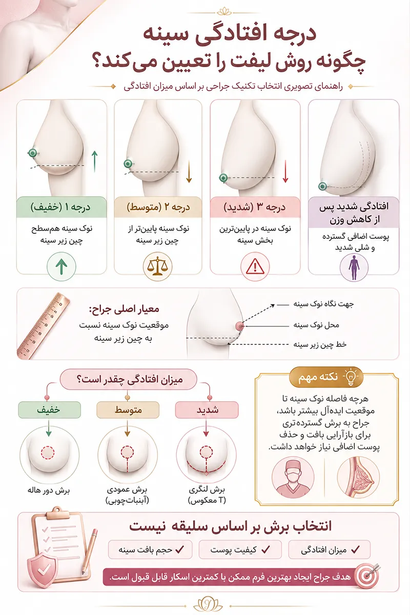 اینفوگرافیک شدت افتادگی سینه چگونه نوع جراحی را تعیین میکند؟