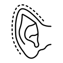 اتوپلاستی