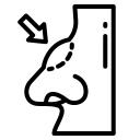رینوپلاستی استخوانی