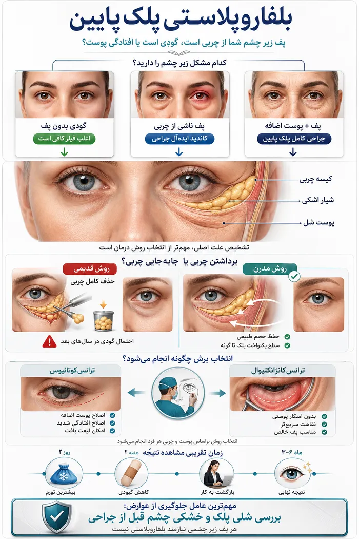 اینفوگرافیک پف زیر چشم بخاطر چربی است یا گودی؟