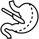 اسلیو معده