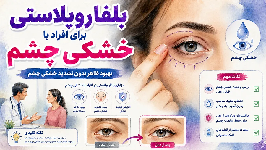 بلفاروپلاستی برای افراد با خشکی چشم
