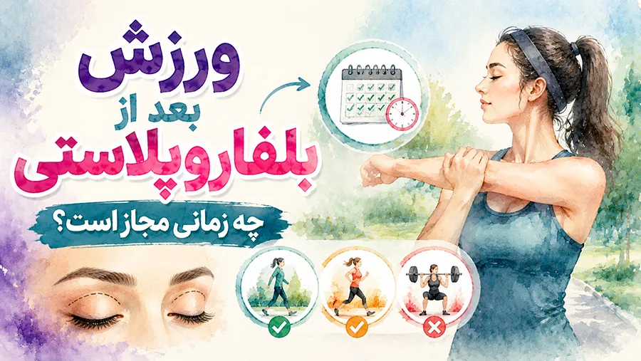 ورزش بعد از بلفاروپلاستی چه زمانی مجاز است؟