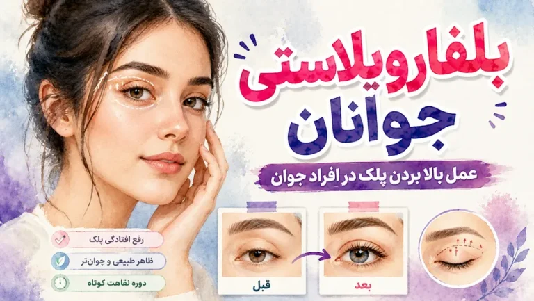 بلفاروپلاستی جوانان: عمل بالا بردن پلک در افراد جوان