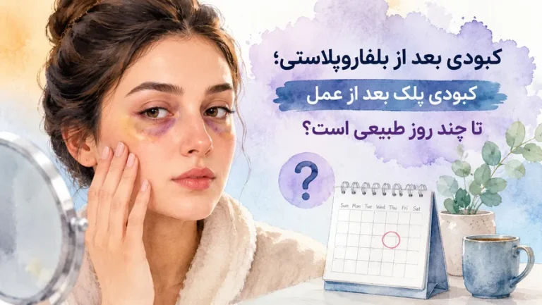 ‫کبودی بعد از بلفاروپلاستی؛ کبودی پلک بعد از عمل تا چند روز طبیعی است؟